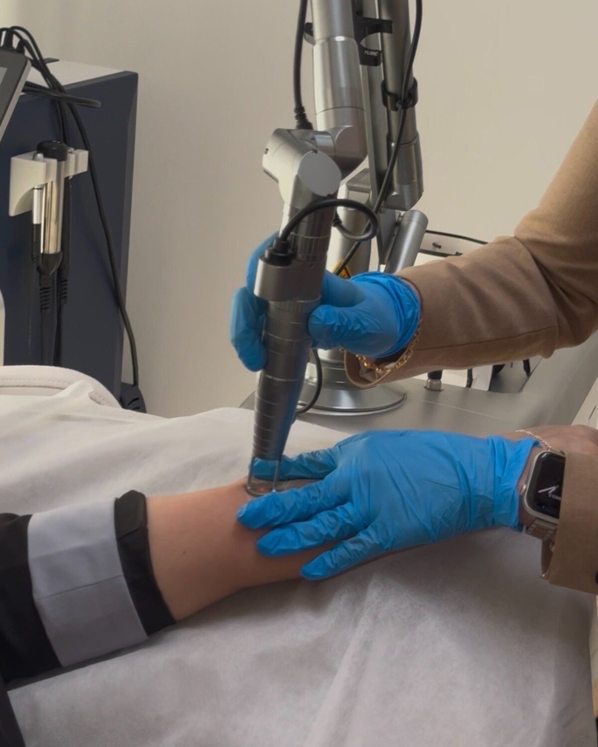 body laser