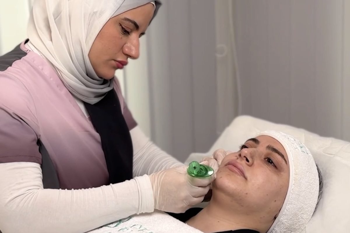 face-botox-dermabloom-medical-center-mirdif-dubai